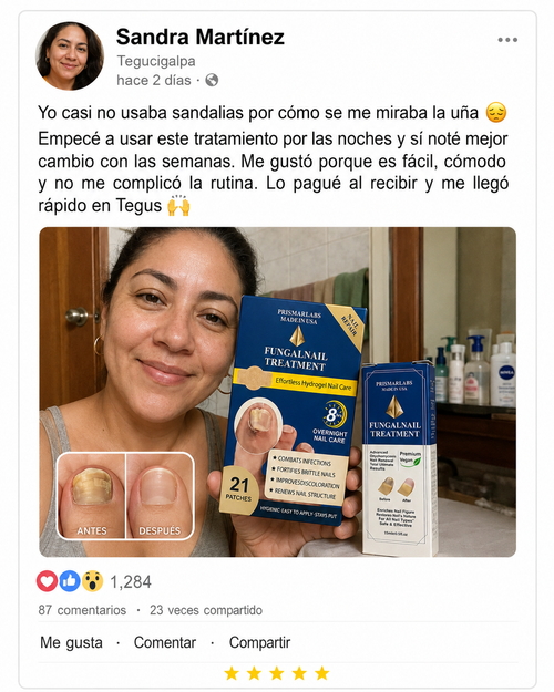 Reseña Kit 2 en 1 para el Cuidado de Uñas Dañadas | Parches Hydrogel + Sérum | Pago al Recibir Honduras