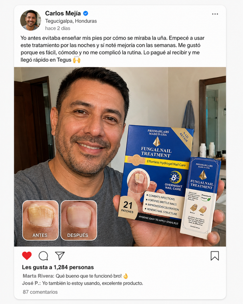 Reseña Kit 2 en 1 para el Cuidado de Uñas Dañadas | Parches Hydrogel + Sérum | Pago al Recibir Honduras